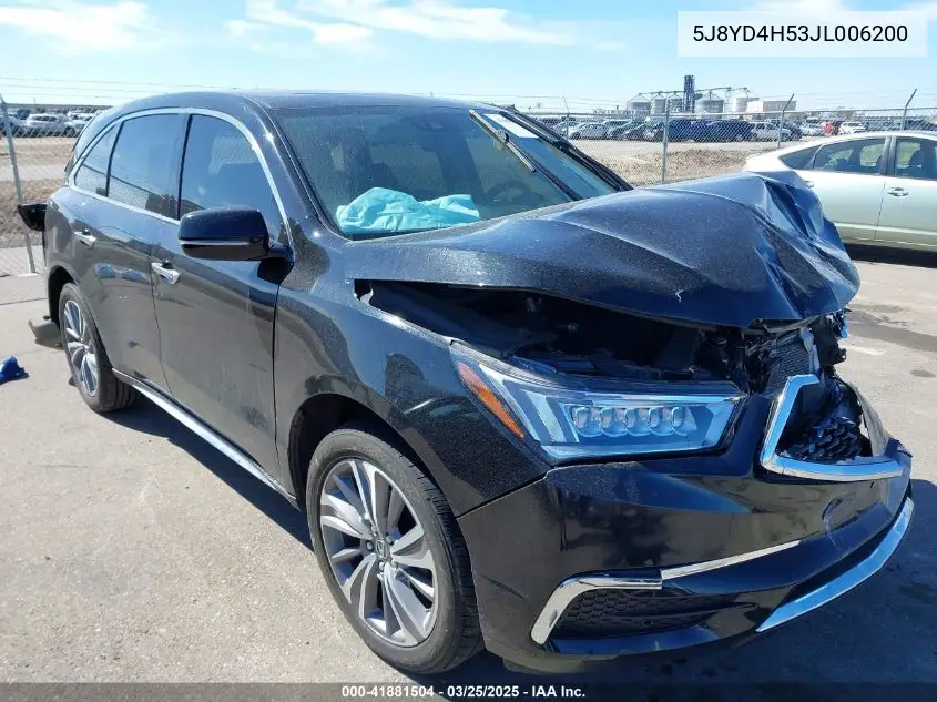 2018 Acura MDX